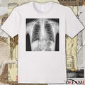 Tyler Shough’s Post-Game X-Ray Confirms He’s Got That Dog In Him t-shirt