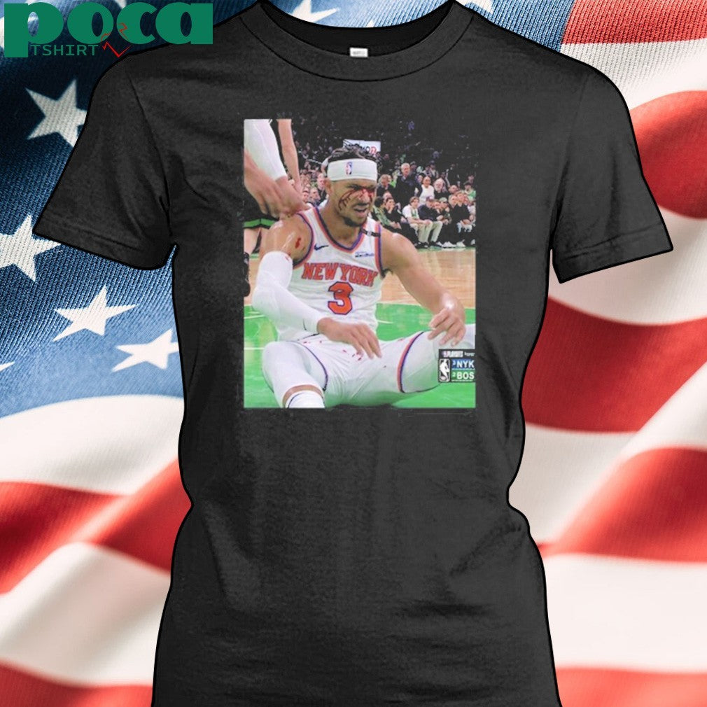 Photos Of Josh Hart After Getting Elbowed In The Face shirt