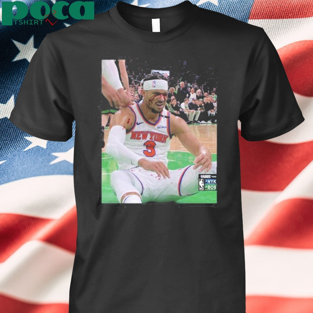 Photos Of Josh Hart After Getting Elbowed In The Face shirt